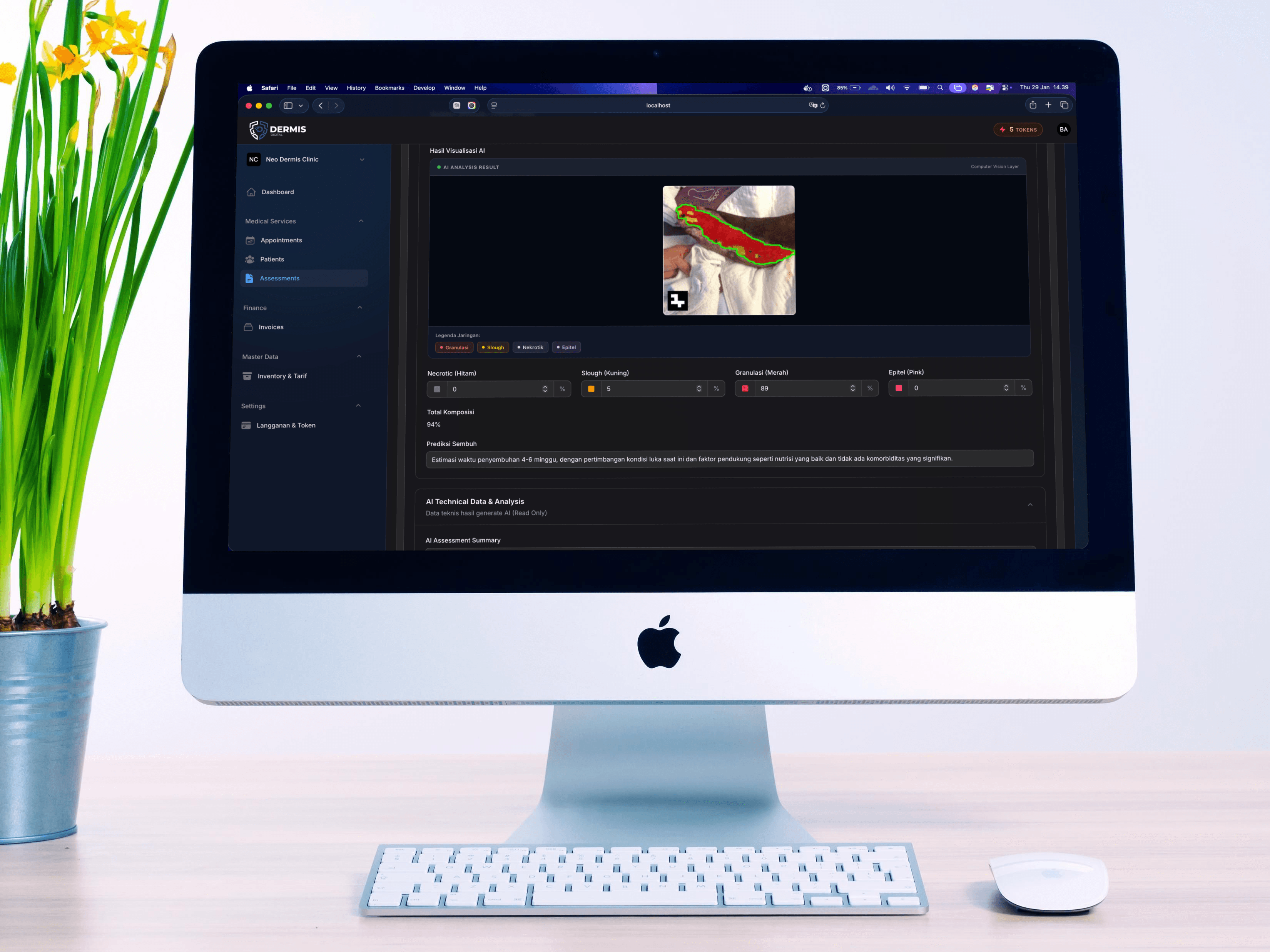 Deteksi Luka dengan Machine Learning - Dermis Digital - image 2