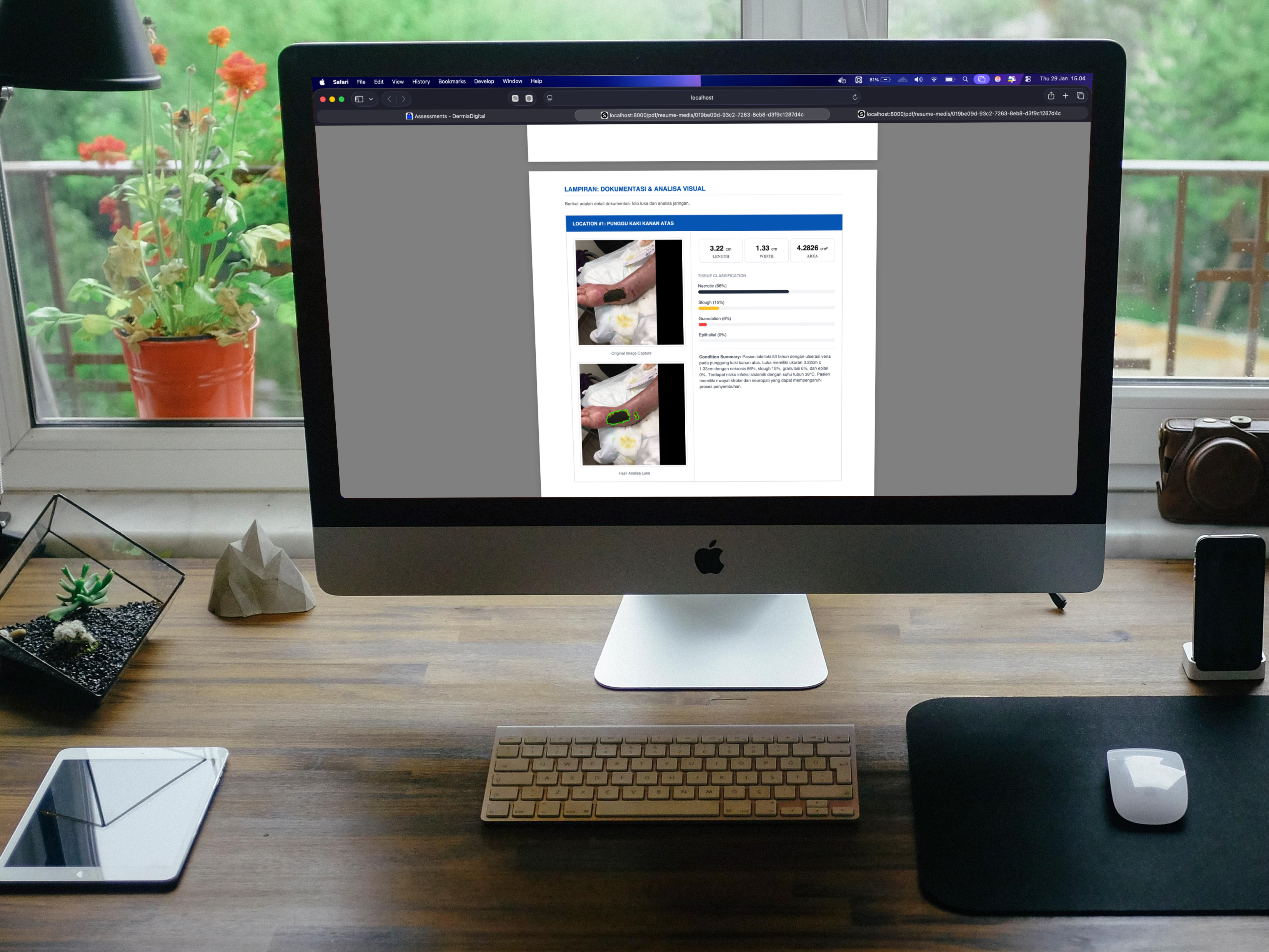 Deteksi Luka dengan Machine Learning - Dermis Digital - image 3